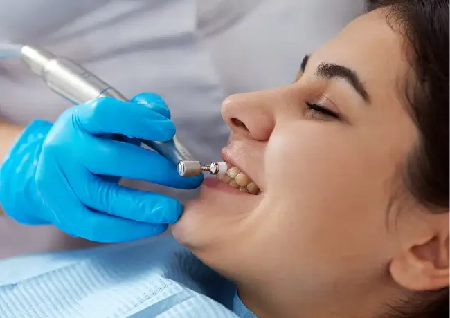 Dental Cleaning Vs. At-Home Cleaning
